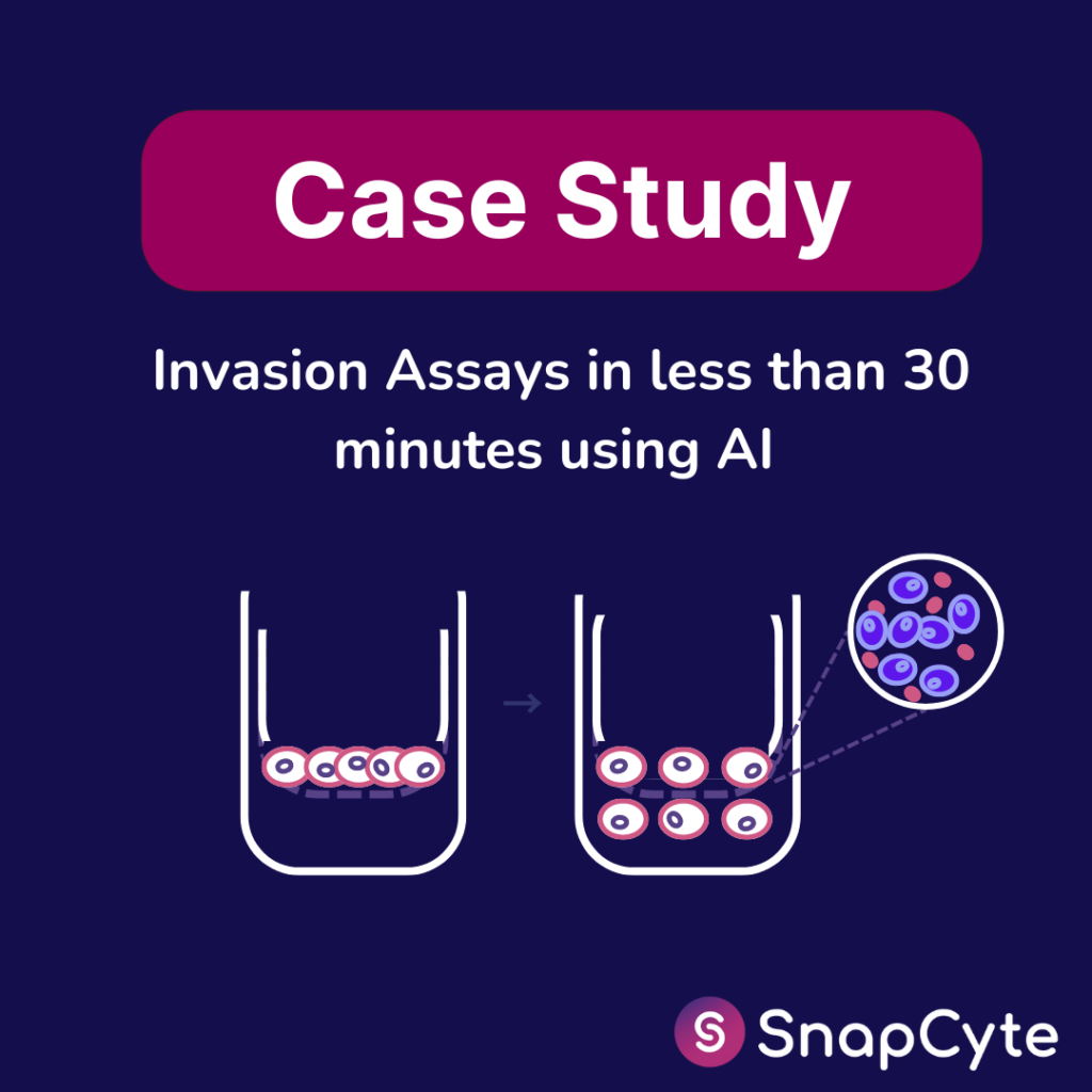 Case Study: Invasion Assay in Less than 30 Minutes using AI