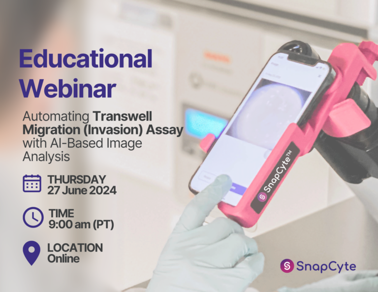 Join us for a webinar where we discuss the challenges of current Transwell assay methods, tips for conducting robust assays, and how AI-based image analysis can provide consistent, reproducible results.