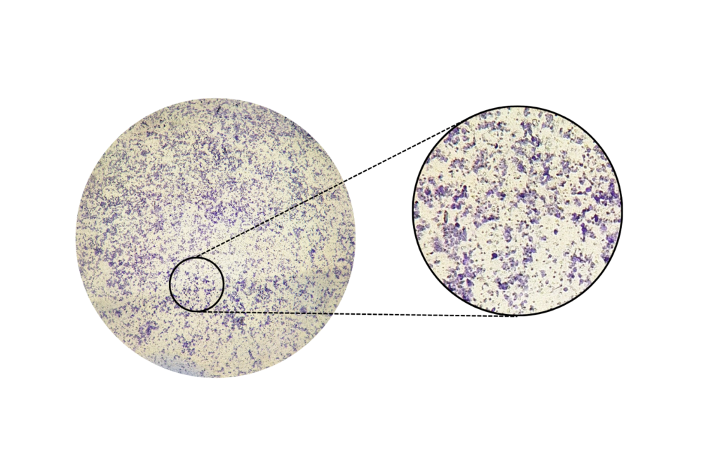 Stained cells ready for the Transwell migration assay or Invasion. assay protocol