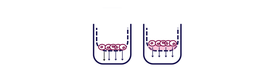 Difference between the Transwell Migration asssay setup and the Invasion Assay.