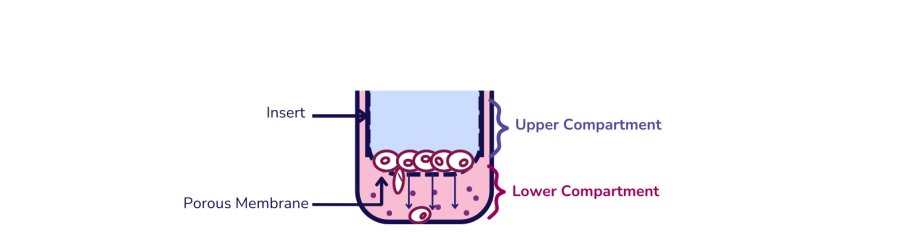 Illustration of how the Boyden chamber is built